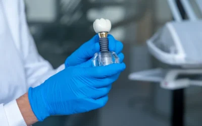 Implantes dentales paso a paso: cómo es realmente el proceso