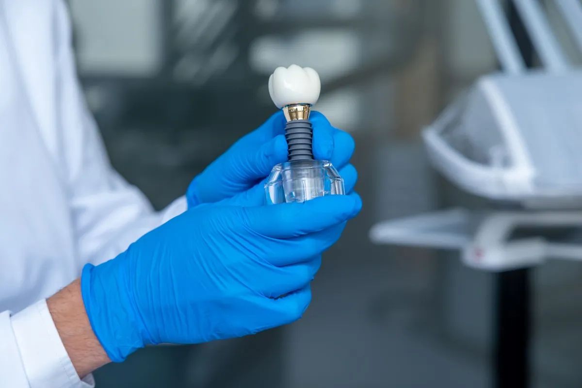 Implantes dentales paso a paso